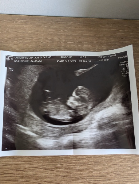 Due February 2025 - Thread 3