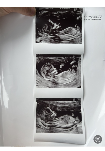 baby gender