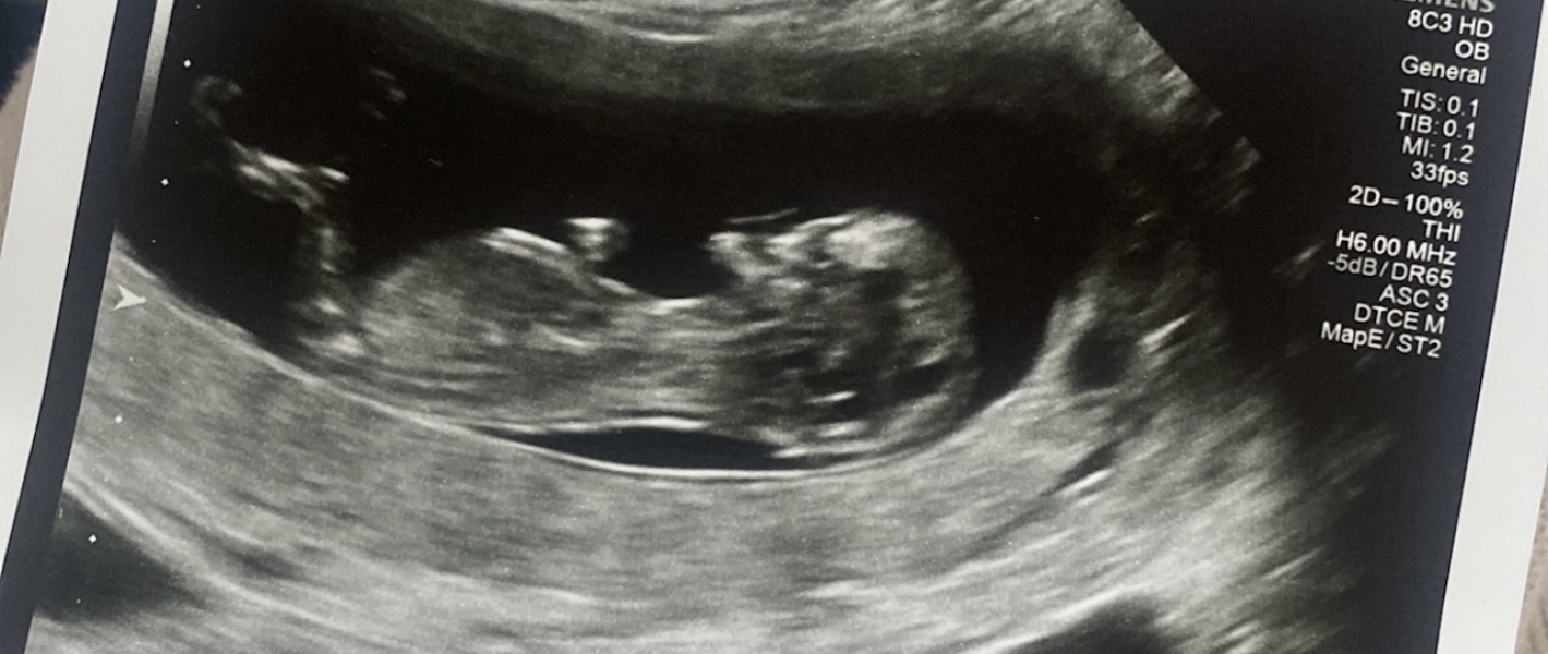 Gender predictions! Where is the baby nub?!?!