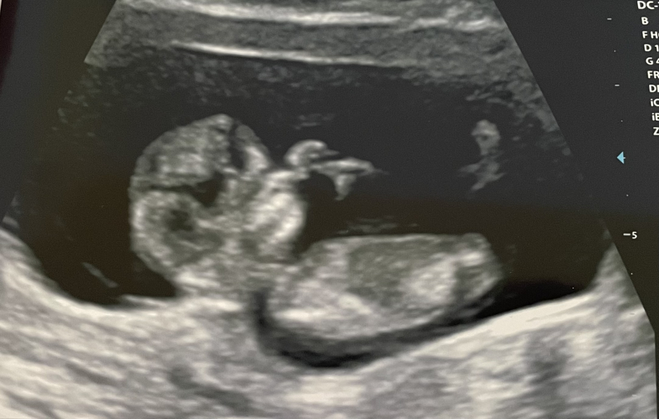 TTC February 2024 ✨