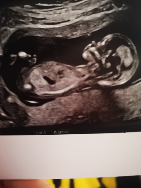 Gender guesses