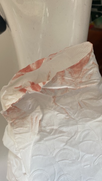 (TW PICTURE) Implantation or ovulation