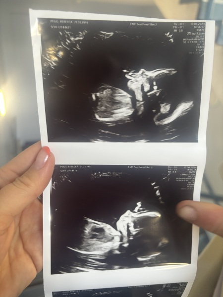 Boy or girl? From scan