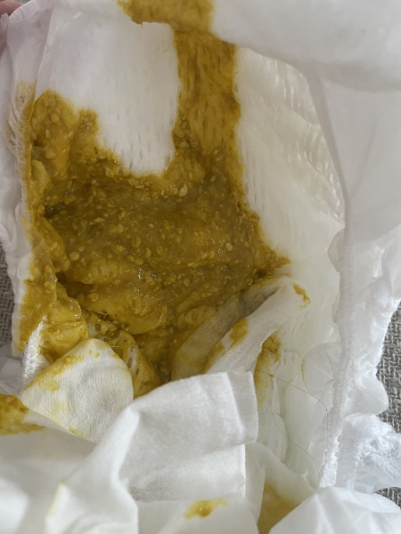 Has my baby got cmpa