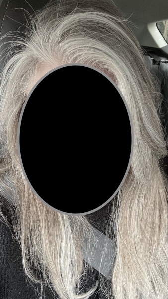 Have you had to let your hair grow grey? Support please