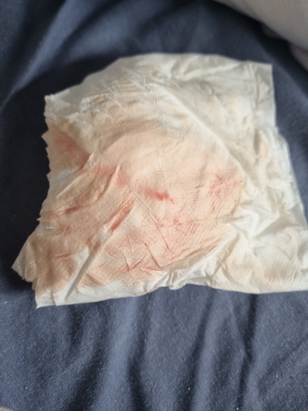 Light pink blood 6 weeks pregnant.. sensitive pics