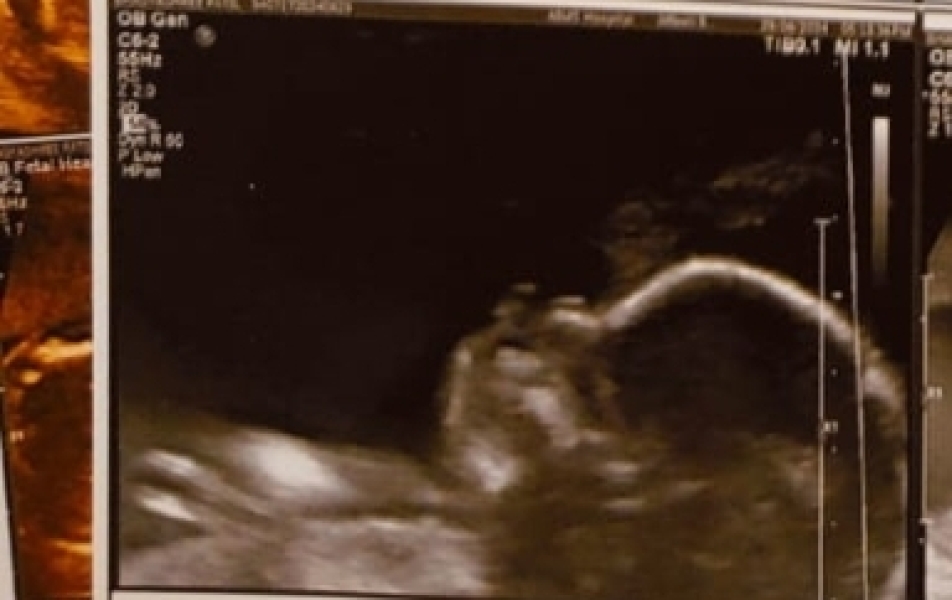 Boy or girl?