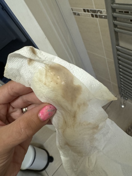 Brown spotting/discharge 7 weeks