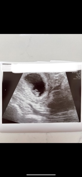 BFP after recent loss (Thread 2) 🌈