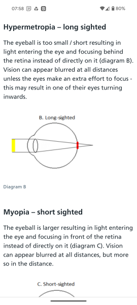 DD age 6, no concerns re eyesight been given v strong prescription for longsightedness but prescription says she is short sighted? 2nd opinion?