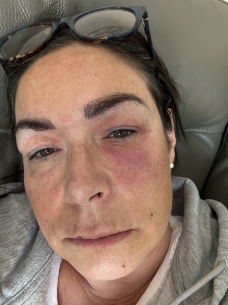 What is this pic on face