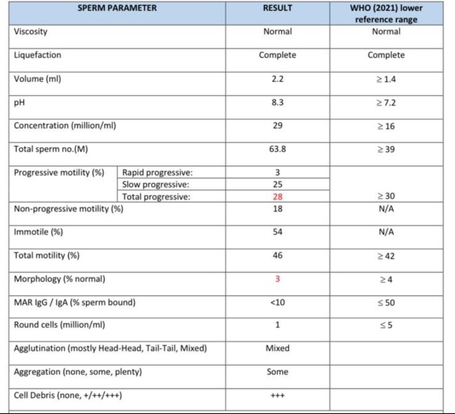 Is conception possible with this sperm sample?