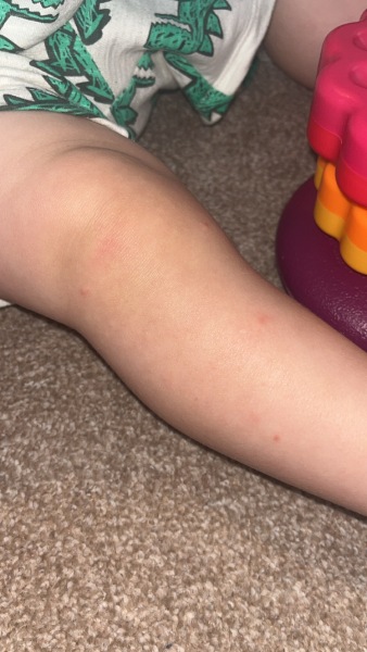 Spots?