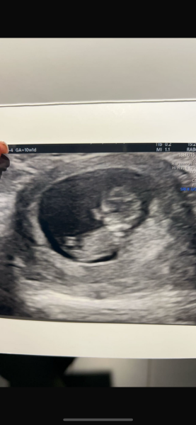 Girl or boy??