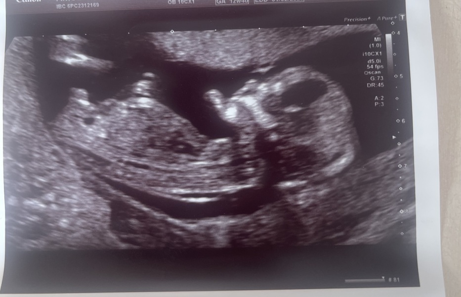 When did i conceive?