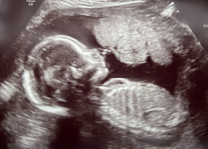 Gender guesses