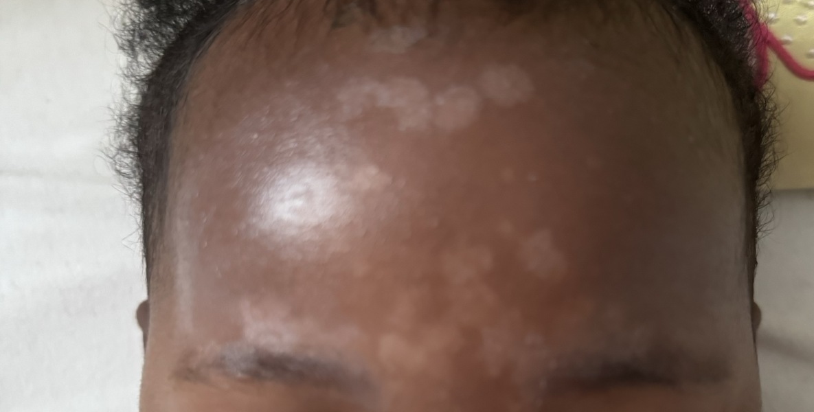 Help with baby's skin