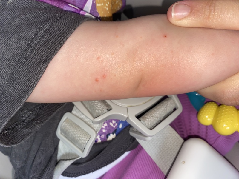 Anyone know what these spots could be??