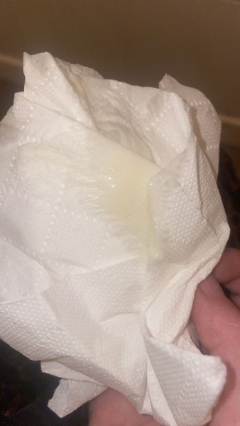 TMI is this discharge normal?