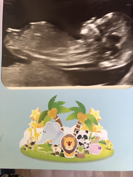 Boy or Girl?