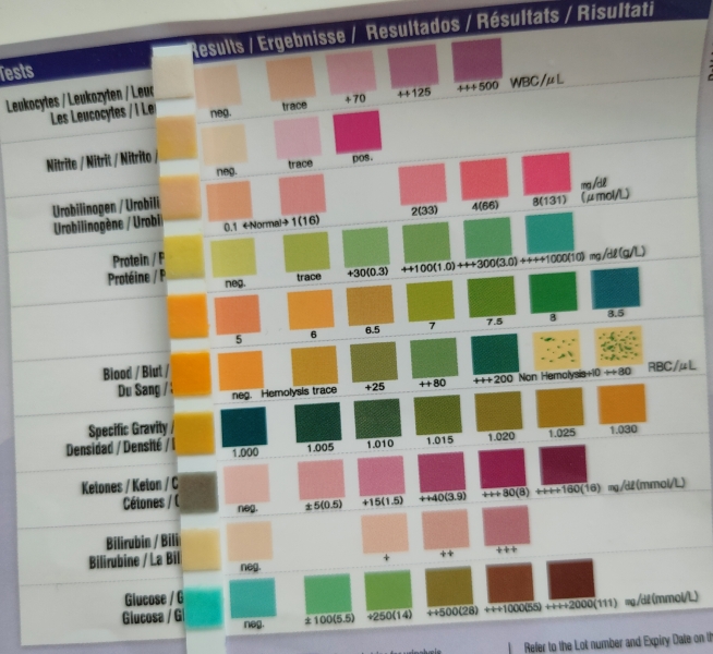 Can anyone help with this urine dip result please...