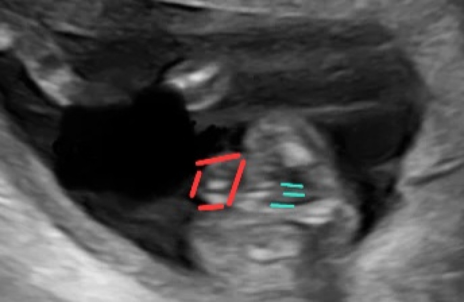 confirmations on my scan help please