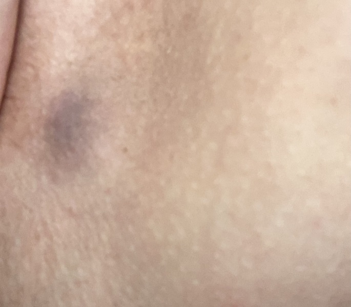 Any idea what this could be. Pic incl
