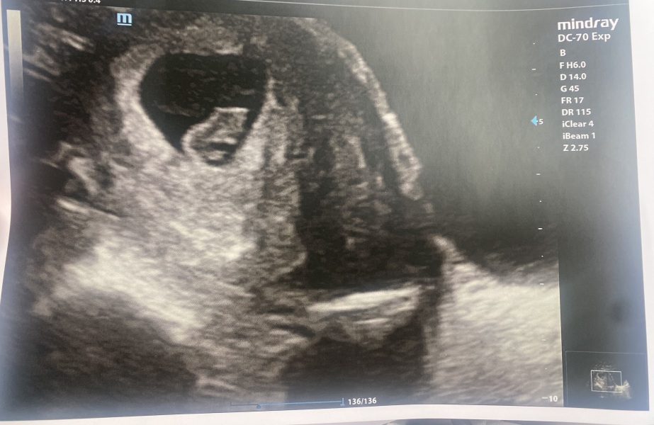 8 week scan