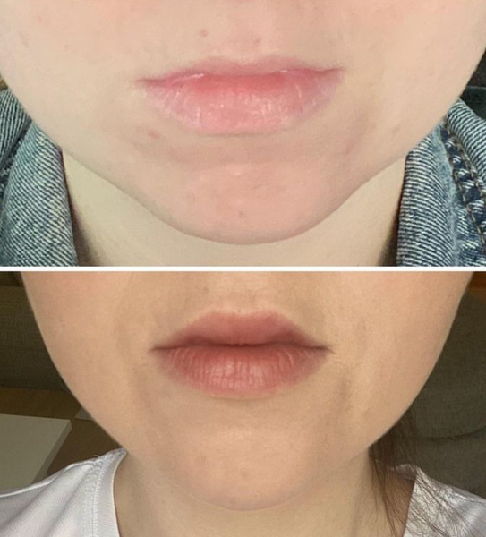 What could be done with my lips? Pics