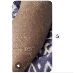 Any dermatologists around please?  Skin condition