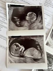 Any guesses for the gender please🩷💙