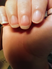 Ridged flakey nails - how to sort them out?