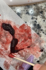 Blood clot or miscarriage? **MNHQ graphic pic warning**