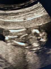 Help with potty shot 14 weeks