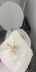 Miscarriage