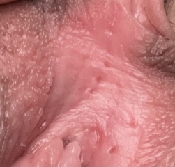 Problem with down below *[content warning: contains pics]