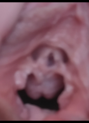 Help, mass under urethra after childbirth