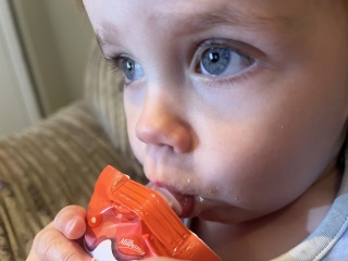 Grey whites of the eyes