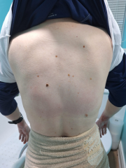Could this rash be a reaction to antibiotics?