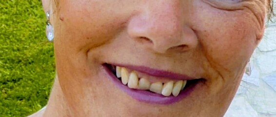 Teeth straightened in fifties?