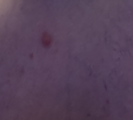 Please help me identify bites!