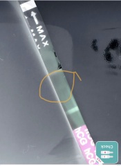 Pregnancy test