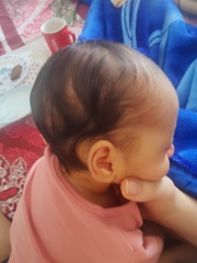 Does my baby have flat head?