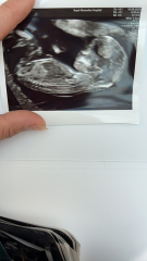 Due February 2025 - Thread 3