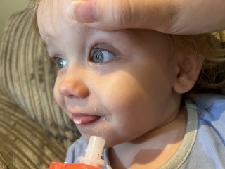 Grey whites of the eyes