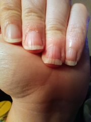 Ridged flakey nails - how to sort them out?
