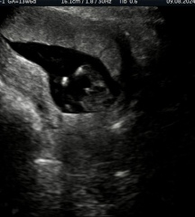 Scan Gender Ideas?