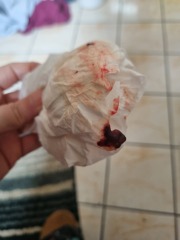 Light pink blood 6 weeks pregnant.. sensitive pics