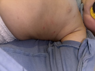 Rash on 7 month old