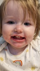 Allergies? Or just skin irritation?